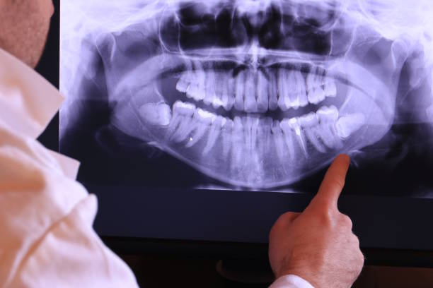 Best Walk-In Emergency Dentist in Mi Wuk Village, CA